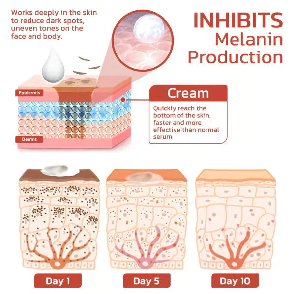 ⚡Anti-Freckle Cream Sale! ⏳🎉